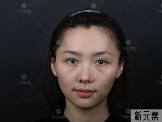 20+就开始做眼部抗衰会不会太早? 图片-3