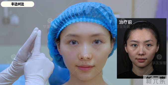 20+就开始做眼部抗衰会不会太早? 图片-8
