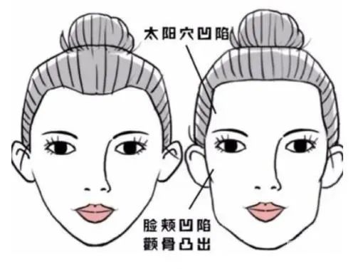 正畸过程中，你可能会遇到的3大问题! 图片-7