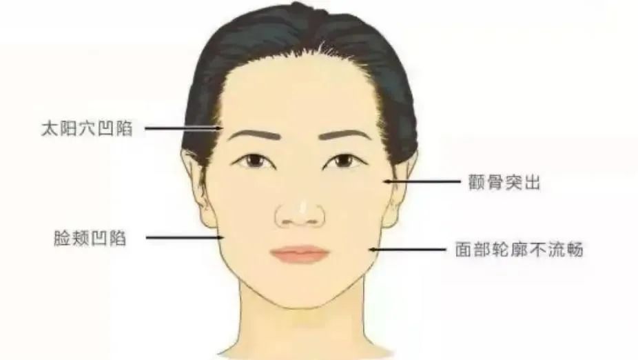 正畸过程中，你可能会遇到的3大问题! 图片-9