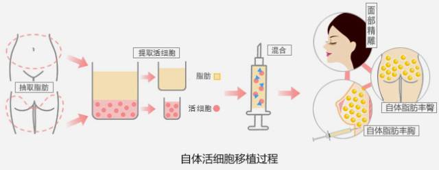 哪些整形手术一起做? 1+1才能大于2 图片-8