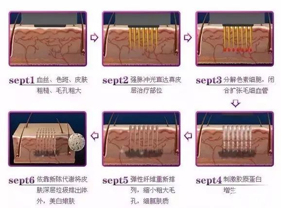 要想拥有好肌肤，必需做好皮肤管理! 图片-4
