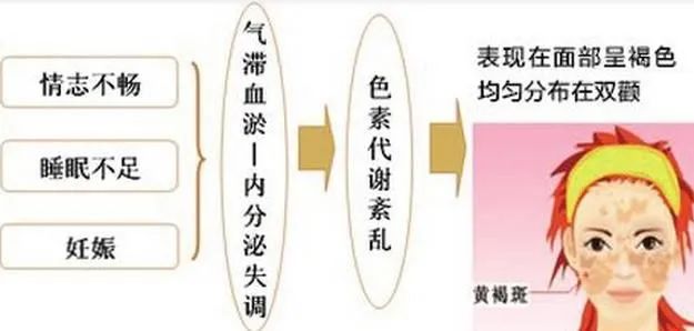 任何人不知道黄褐斑这些小知识我都会伤心的好吗? 图片-6