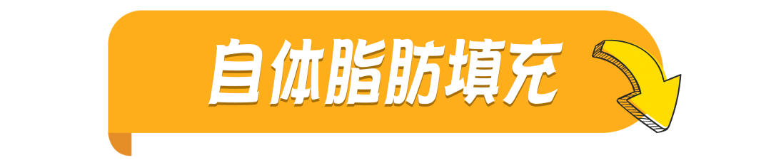 自体脂肪必看攻略 