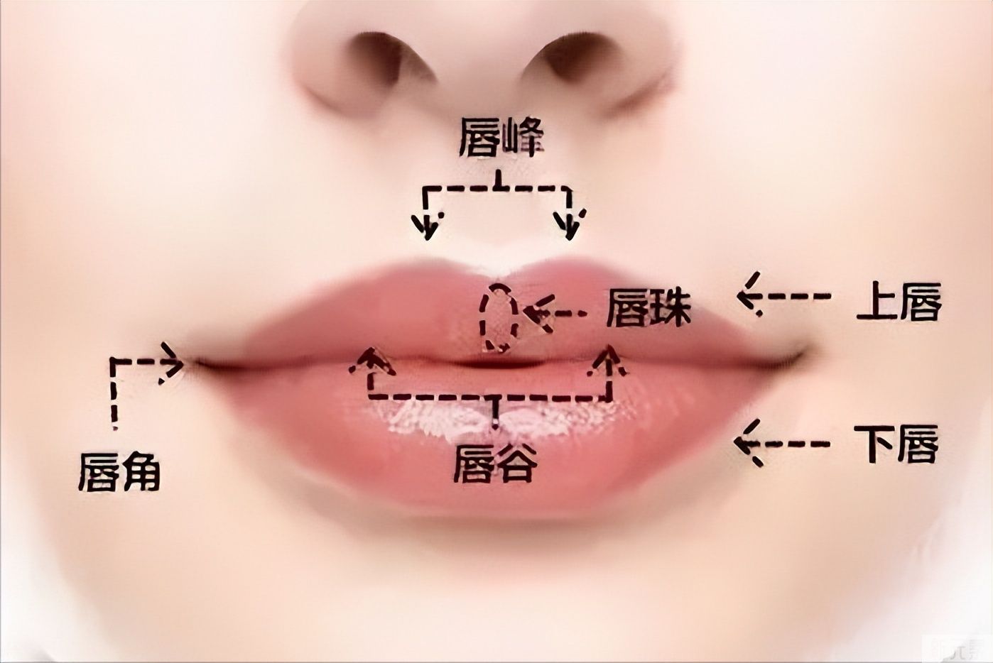 简谈唇部整形(一) 图片-1