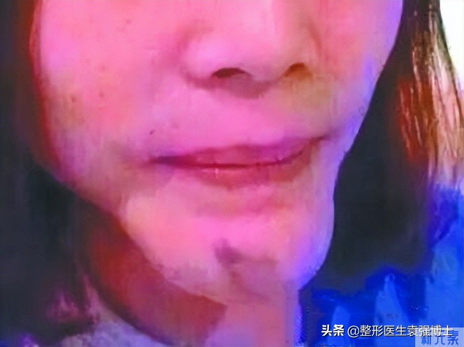医美小白做医美，不懂这些，小心多走弯路 图片-4