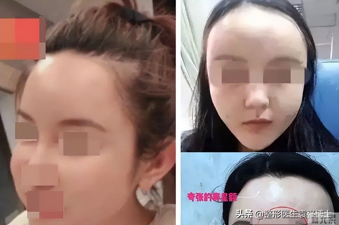 医美小白做医美，不懂这些，小心多走弯路 图片-3