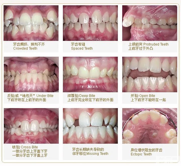 相同部位老是口腔溃疡，其实是这个原因! 图片-4