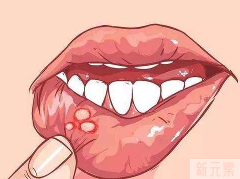 相同部位老是口腔溃疡，其实是这个原因! 图片-2