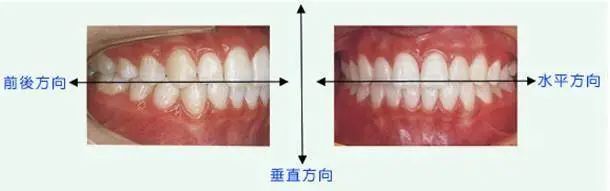 相同部位老是口腔溃疡，其实是这个原因! 图片-5