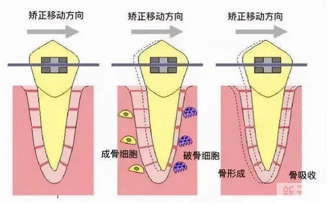 相同部位老是口腔溃疡，其实是这个原因! 图片-7