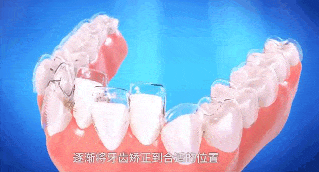 相同部位老是口腔溃疡，其实是这个原因! 图片-15