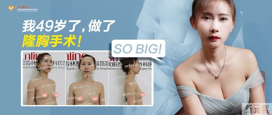 美丽无惧年龄，我49岁了做了隆胸手术!! 