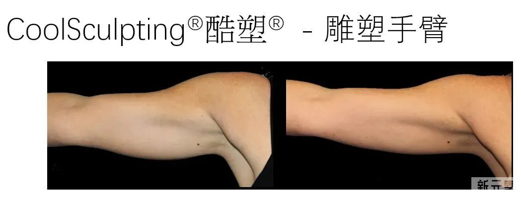 想要轻松瘦身，不妨试试这些方法... 图片-13