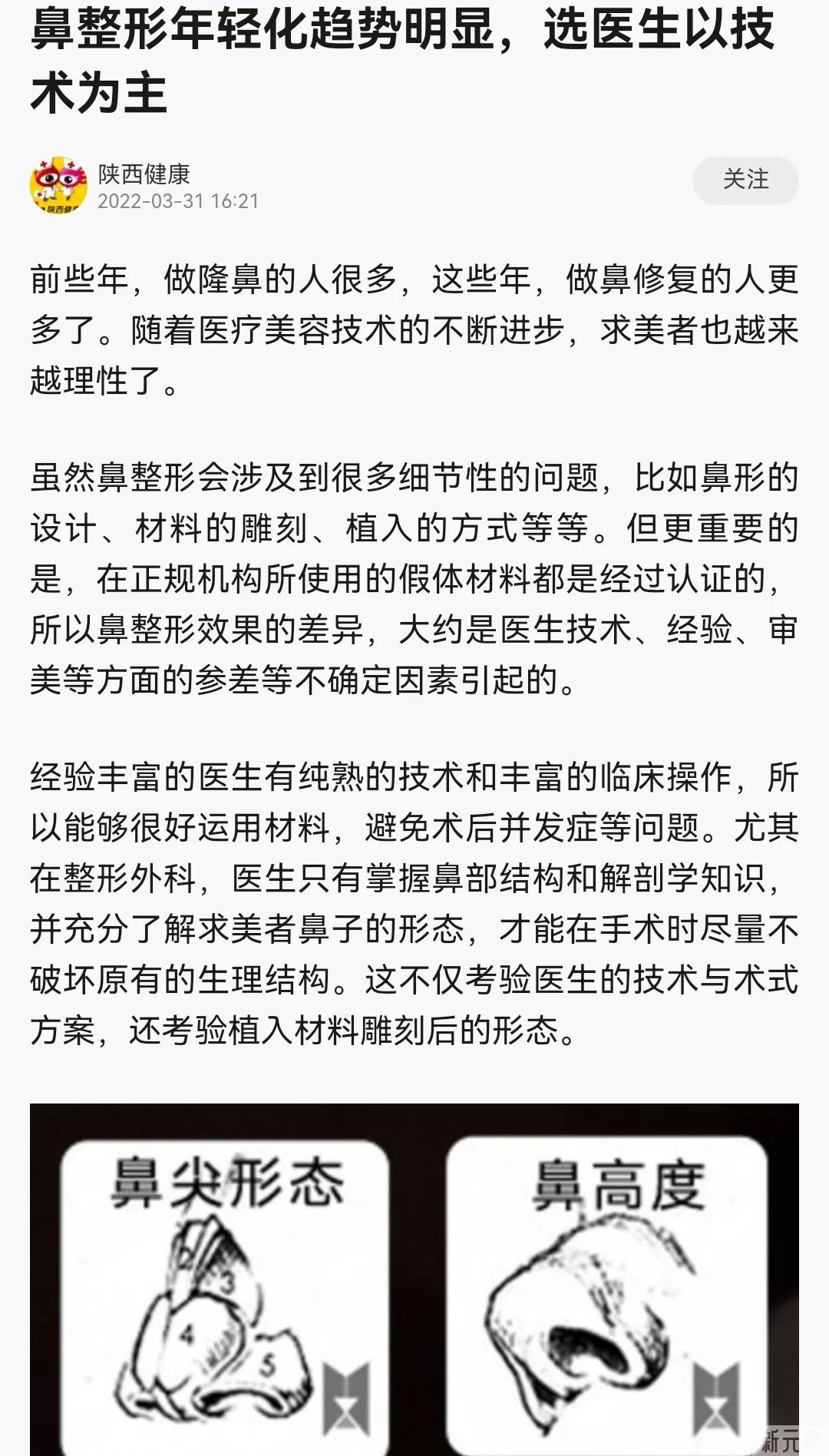 【媒体聚焦】 专访Yestar艺星燕尾榫®鼻整形新技术 图片-3