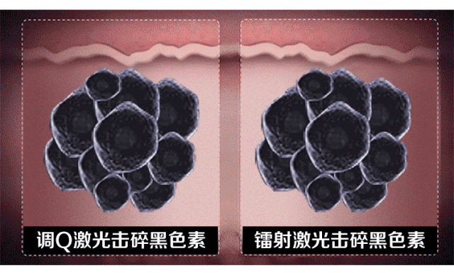 【医美科普】想要美白的请看这里! 图片-4