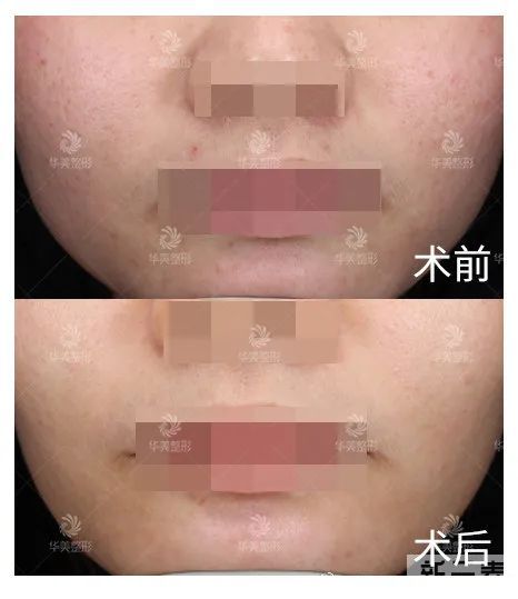 【医美科普】想要美白的请看这里! 图片-7