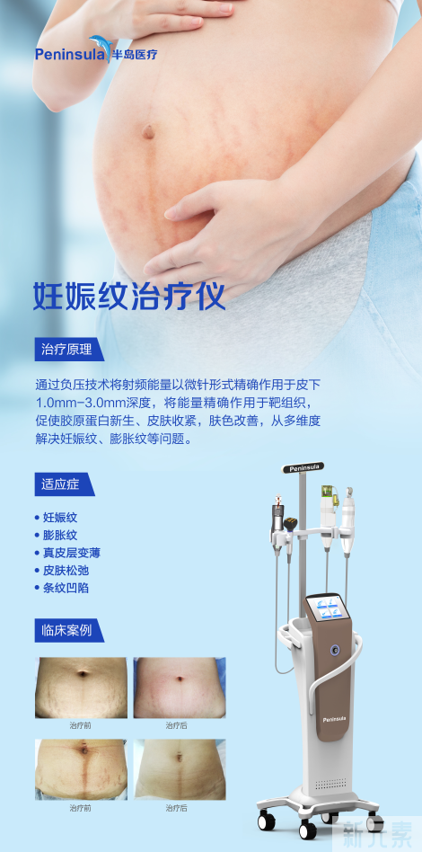第四代黄金射频微针，不仅能除皱抗衰，还能抚平妊娠纹~ 图片-4