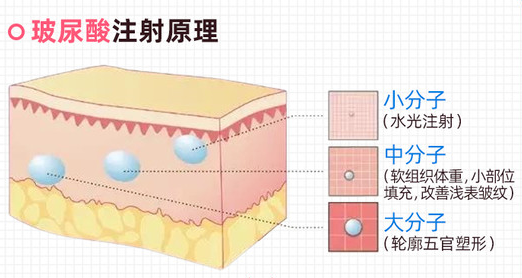 一条纹老十岁!颜值克星「法令纹」怎么去除? 图片-7