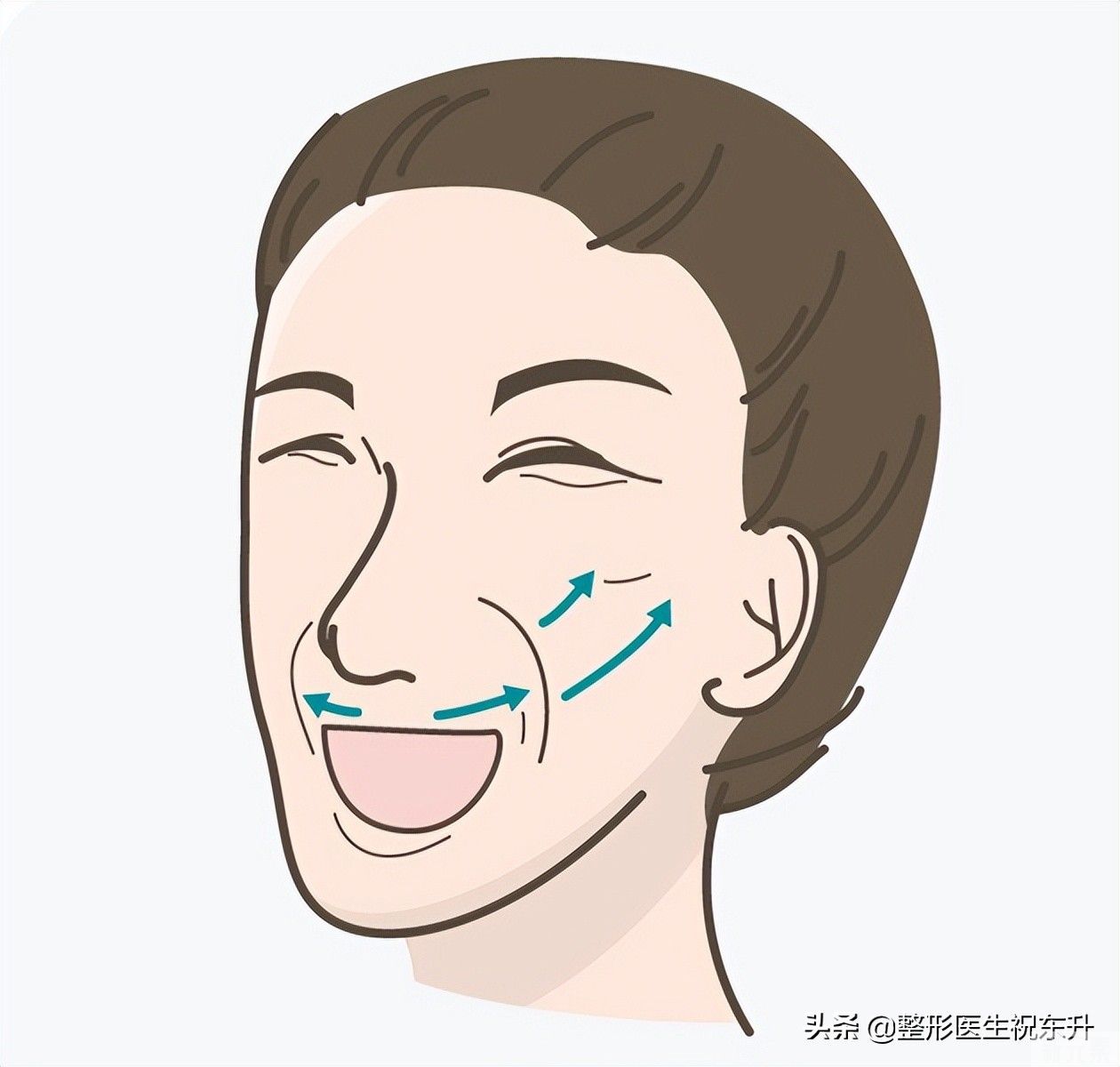 你是什么类型的法令纹，就用什么方法去除 图片-1