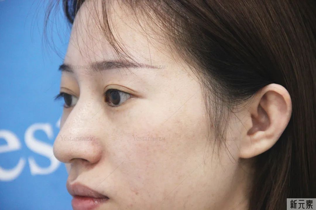 多喝柠檬水不能美白?先了解你的美白上限... 图片-8