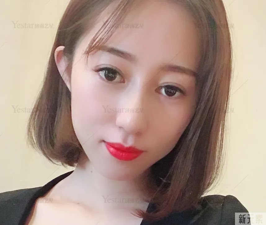 多喝柠檬水不能美白?先了解你的美白上限... 图片-9