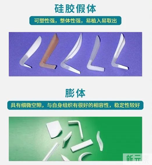 ​做耳软骨隆鼻你在担心什么? 图片-7