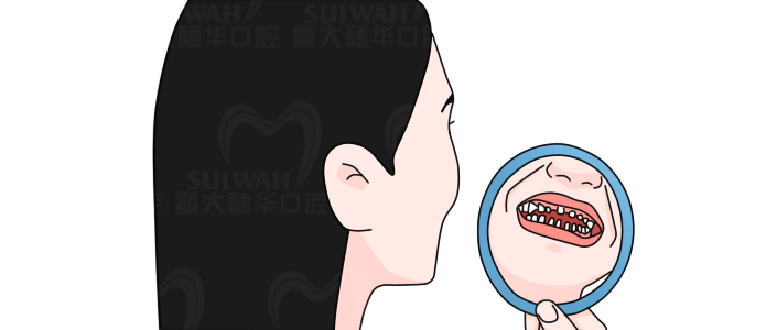 拔牙后不处理真的好吗? 图片-3