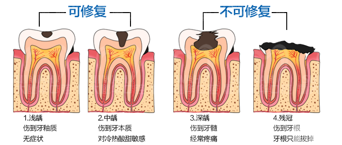 拔牙后不处理真的好吗? 图片-9