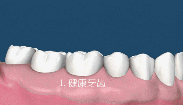 涨姿势 | 10个口腔实用小知识，一定有你想知道的! 图片-10
