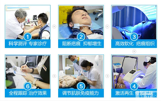 从颜色就能判断疤痕增生程度!来看看自己处于哪个阶段了 图片-11