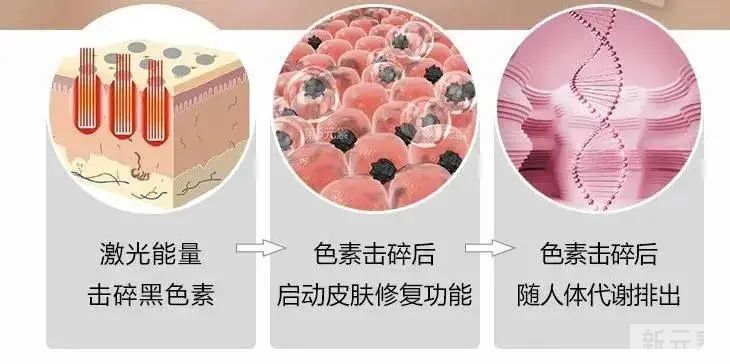 一年之“肌”在于春，get这款美肌黑科技，让你秒变素颜美女 图片-3