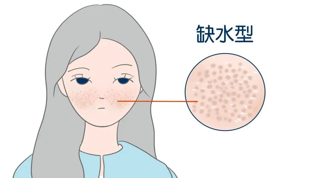 缩毛孔的正确打开方式! 图片-6