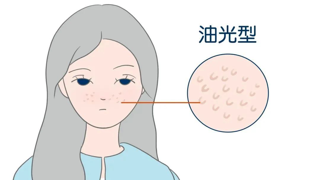 缩毛孔的正确打开方式! 图片-5