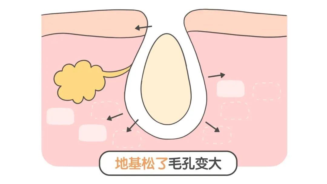 缩毛孔的正确打开方式! 图片-4