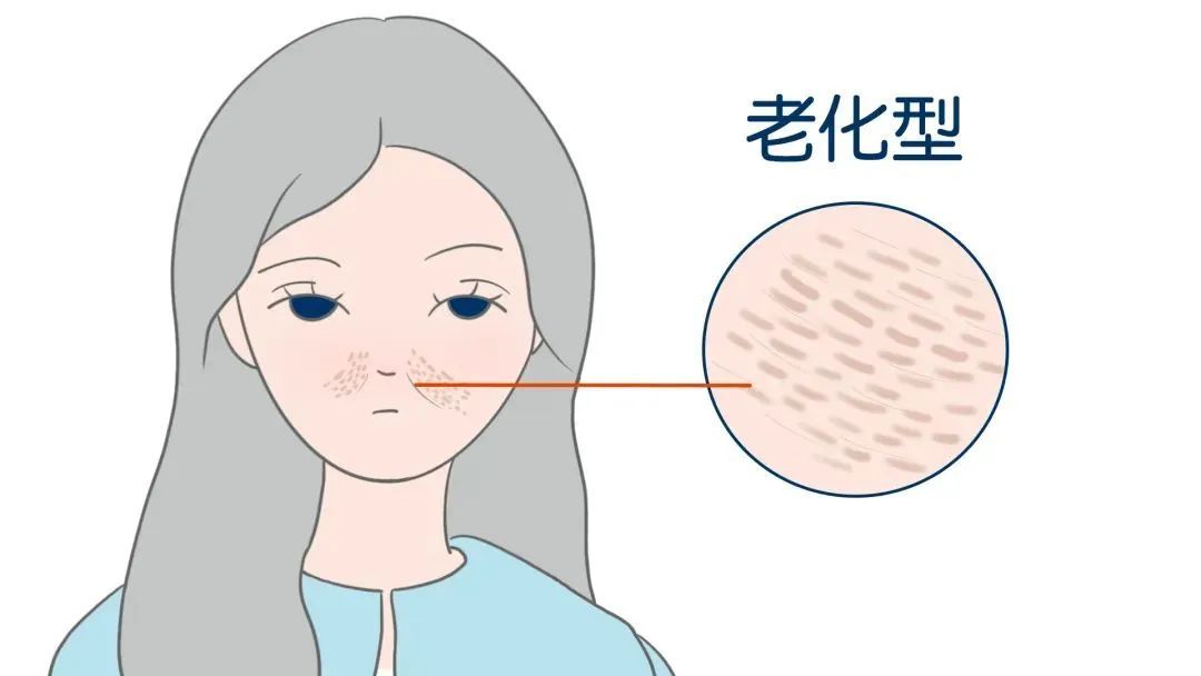 缩毛孔的正确打开方式! 图片-8