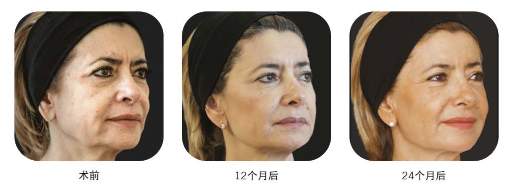 雅涵“少女针”——领取你的“针”爱 图片-13