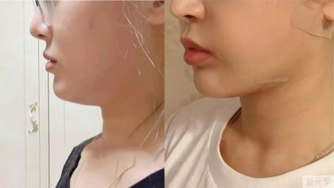 想要保持少女感，光靠脸蛋紧致还不够! 图片-9