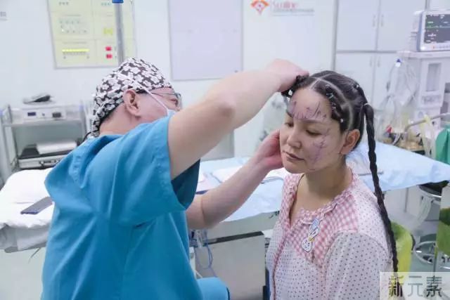 沈阳杏林整形除皱案例 | 这个立竿见影的抗衰手术，胜在哪里? 图片-3