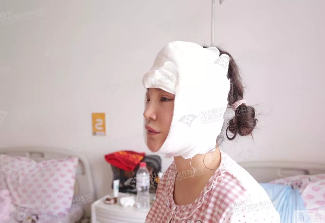 沈阳杏林整形除皱案例 | 这个立竿见影的抗衰手术，胜在哪里? 图片-5
