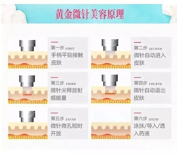 都过了青春期，为什么还是频繁长痘? 图片-12