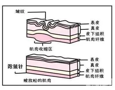 不许你不知道!这些不良习惯正在悄悄拉低你的颜值! 图片-4