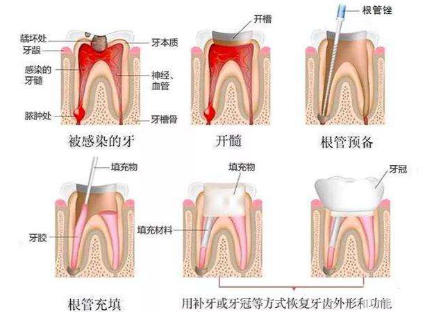 科普来了， 为什么一到晚上牙齿就加剧疼痛? 图片-7