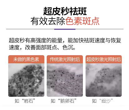 超皮秒:强于祛斑 又不止于祛斑 图片-6