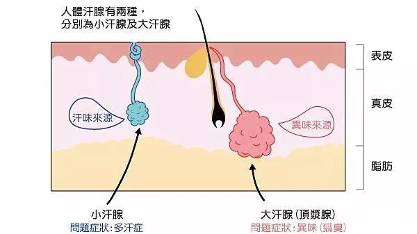 除腋臭 | 为防夏季尴尬，我可是找遍了方法! 图片-5