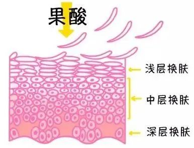 刷酸到底会不会让皮肤变薄?真的酸q了... 图片-7