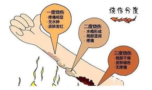小时候烫伤后，家人都给抹过哪些奇葩的东西，大部分人都经历过.. 图片-9