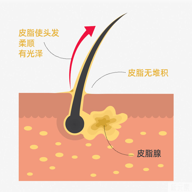 ​头皮爱出油一定会脱发吗?应该如何改善? 图片-2