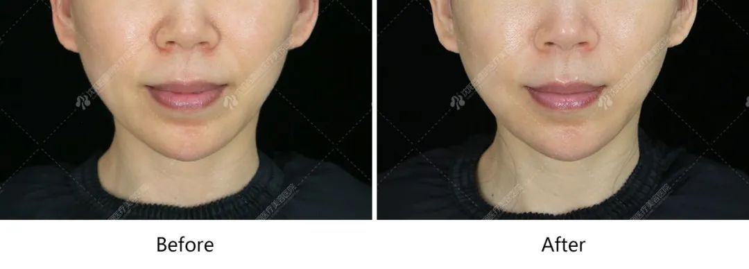 口周开始“不支棱”?40+50+60+的女性，是这么变美的! 图片-8