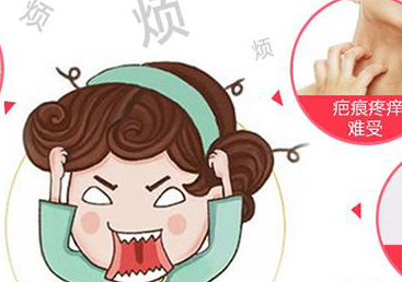 小心!你长的痘痘痤疮很可能会留下这2种疤痕 图片-5